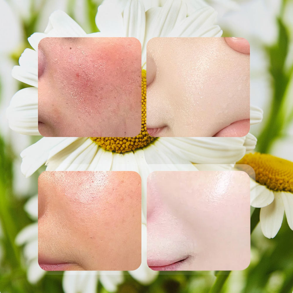 For Fykly Rose VC Chamomile B5 - Face Mask Skincare review and price