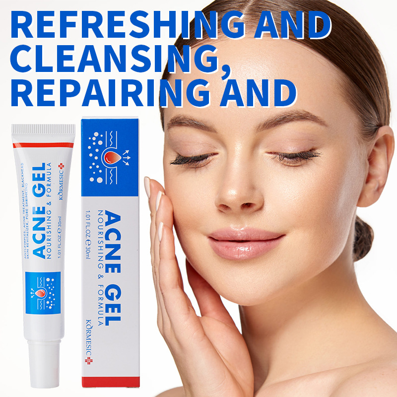 30g Acne Removing gel Deep Cle - Face Moisturizer review and price